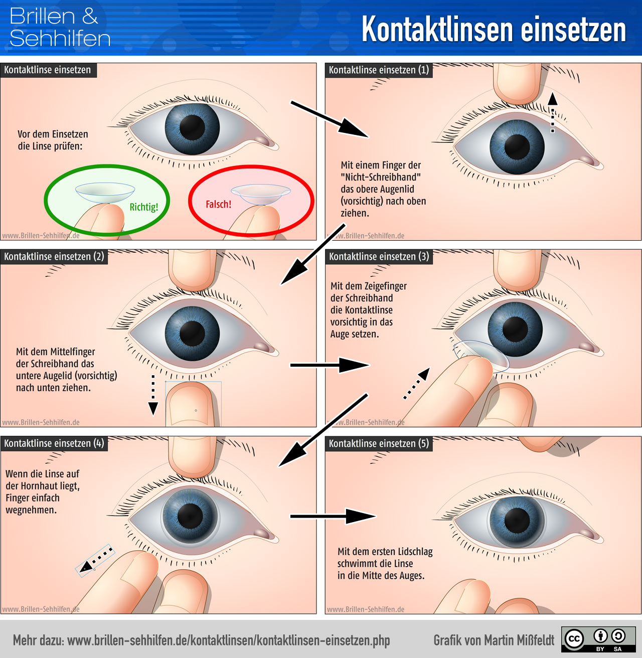 4 Stück Kontaktlinsen Hilfe zum Einsetzen mit Aufbewahrungsflasche,  Tragbarkeit Kontaktlinsen Sauger Weiche Linsen, Silikon Kontaktlinsen